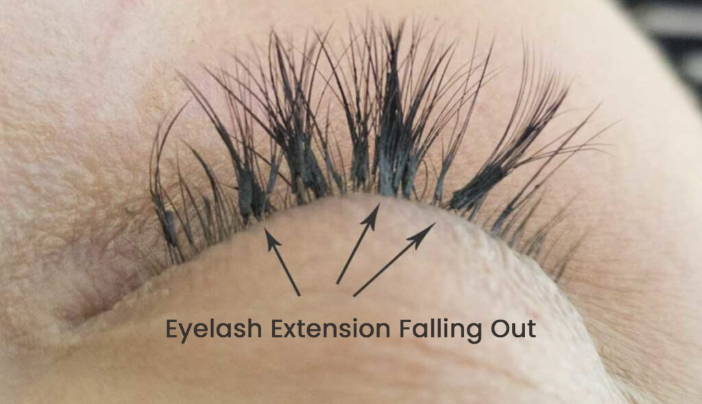 eyelash extension falling out